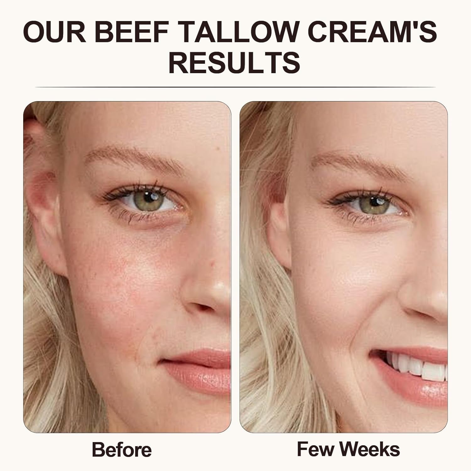Beef Tallow,Beef Tallow for Skin,Beef Tallow Face Moisturiser, Organic Beef Tallow Skin Care, Grass Fed Beef Tallow Cream, Moisturizer and Nourishes for Face & Body 1Pc
